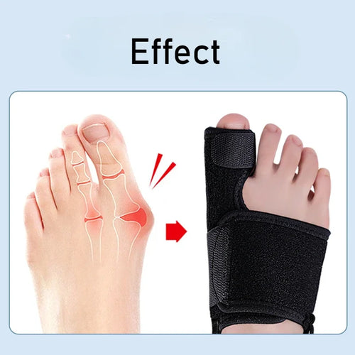 Flexible Toe Separator Splint for Hallux Valgus Bunion Correction, Orthotic Foot Straightener for Bone Alignment and Pedicure Care