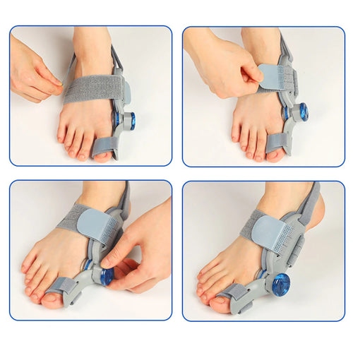 Bunion Splint Big Toe Straightener Hallux Valgus Correction Orthotic for Foot Bone Alignment and Bunions Relief