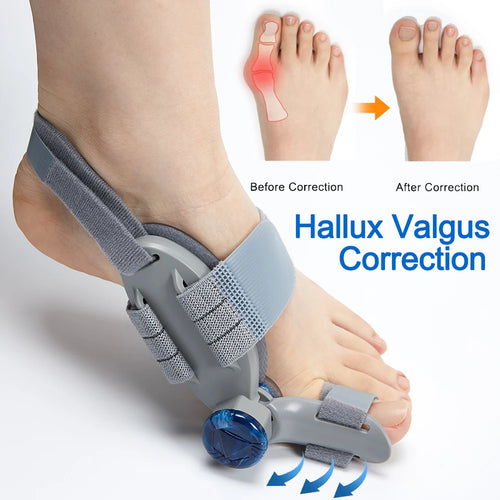 Bunion Splint Big Toe Straightener Hallux Valgus Correction Orthotic for Foot Bone Alignment and Bunions Relief